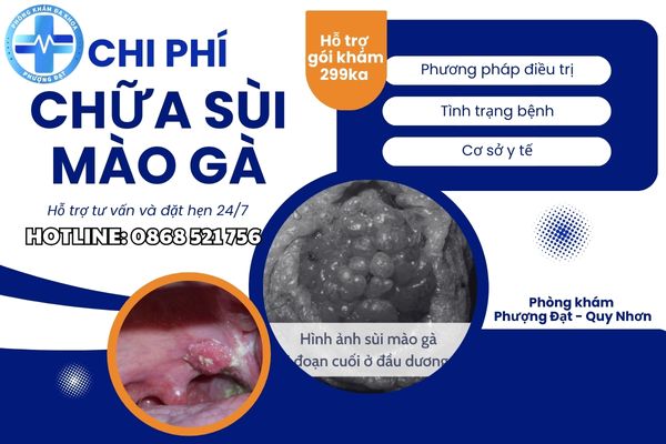 Chi phí xét nghiệm và chữa sùi mào gà