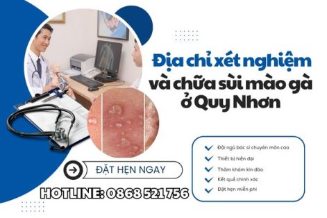 Địa chỉ xét nghiệm và chữa sùi mào gà ở Quy nhơn uy tín