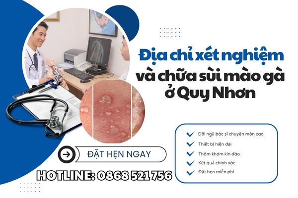 Địa chỉ xét nghiệm và chữa sùi mào gà ở Quy nhơn uy tín