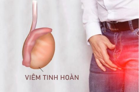 Địa chỉ điều trị viêm tinh hoàn uy tín, hiệu quả nhanh