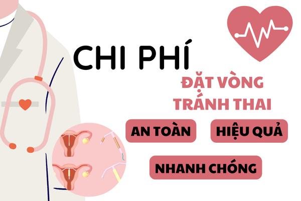 Chi phí đặt vòng tránh thai