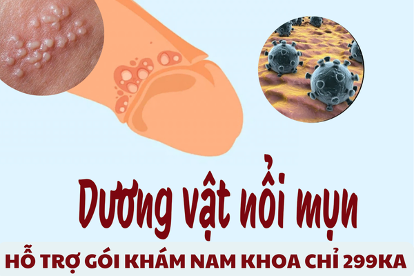 Địa chỉ chữa mụn dương vật ở Quy nhơn hiệu quả – uy tín