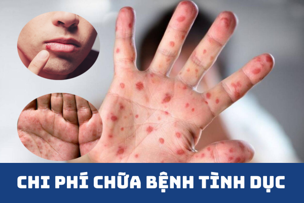 Chi phí chữa bệnh tình dục ở Quy Nhơn