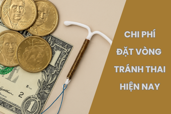 Chi phí đặt vòng tránh thai hiện nay tại Quy Nhơn