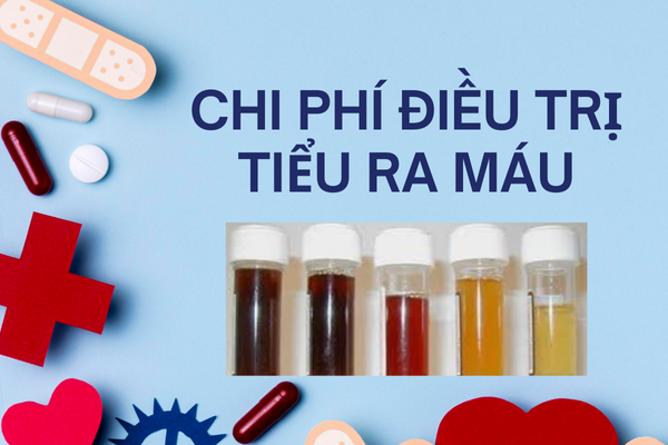 Chi phí điều trị tiểu ra máu