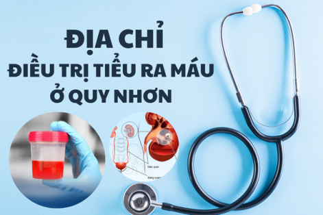 Địa chỉ chữa tiểu ra máu ở Thị xã Sông Cầu an toàn – hiệu quả