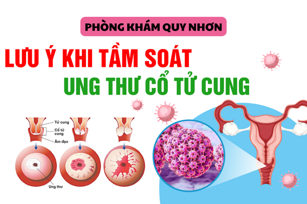 Các lưu ý khi tầm soát ung thư cổ tử cung