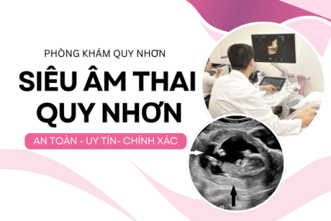 Bác sĩ tiết lộ địa chỉ siêu âm thai ở Quy Nhơn chính xác, uy tín