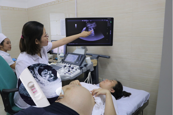Trễ kinh bao lâu thì cần siêu âm thai
