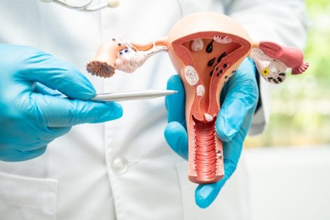 Ung thư cổ tử cung là gì? Hướng dẫn nhận biết và điều trị sớm hiệu quả