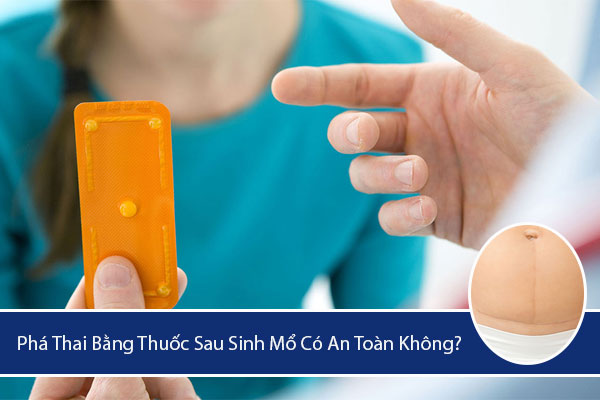 Phá thai bằng thuốc sau sinh mổ có an toàn không?